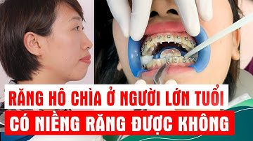 Răng Hô Chìa Ở Người Lớn Tuổi Có Niềng Răng Được Không ?