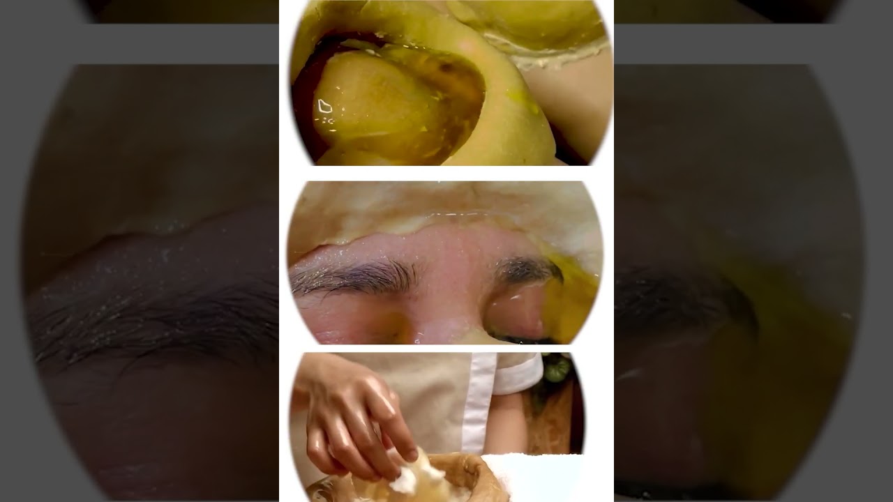 JANU VASTI  KATI VASTI AND NETRA VASTI | CHANDIGARH AYURVED CENTRE