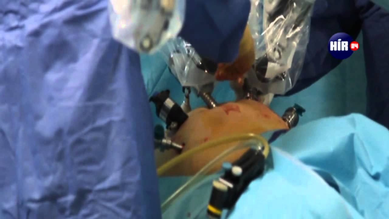 turp műtét videó