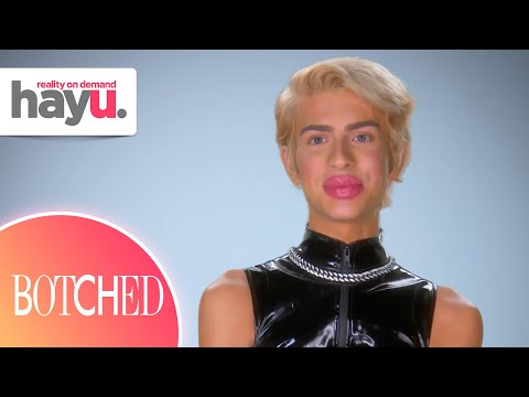 Sugar Baby Wants to Double the Size of Their Lips | Season 7 | Botched