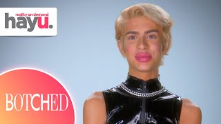 Sugar Baby Wants to Double the Size of Their Lips | Season 7 | Botched