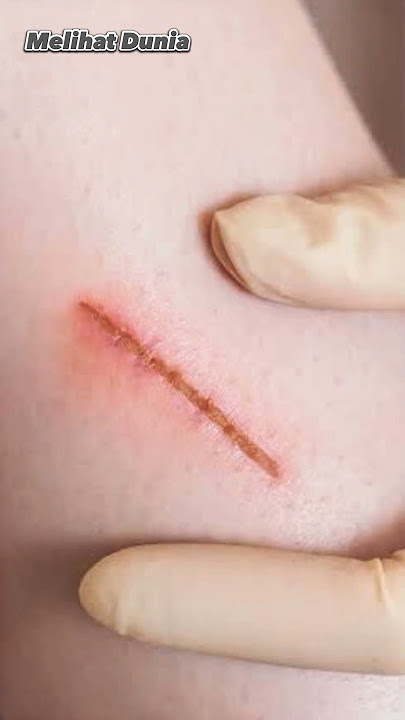 Tahukah kamu? sayatan kertas lebih sakit daripada pisau😱 #shorts #luka #edukasi #kertas #pisau #info