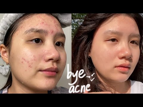 Video: Mario Badescu AHA và Đánh giá Kem dưỡng ẩm Ceramide