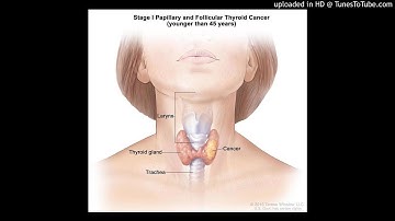 Long non-coding RNAs (lncRNAs) in thyroid cancer