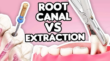 Root Canal vs. Tooth Extraction: What’s the Right Choice?
