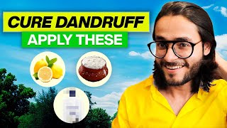 How to Cure DANDRUFF (100% Works)