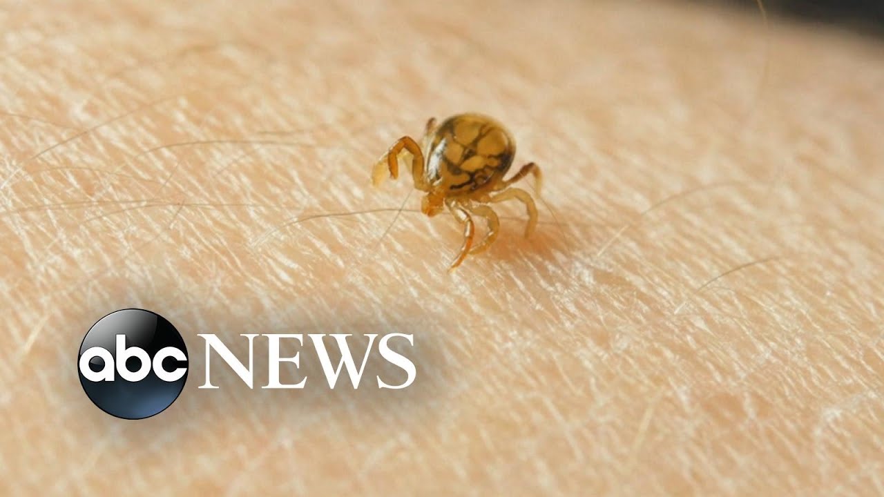 Rare tick virus is on the rise