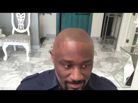 Video thumbnail: The Hair Simulation Company- Update Mr RH 11 Months later