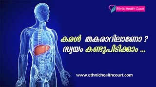 Alcoholics ? Tips to Find Out Liver Damage | Liver Disease Symptoms Malayalam | Ethnic Health Court
