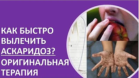 23. Как быстро вылечить аскаридоз? Оригинальная терапия