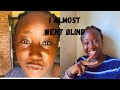 EVERYONE IN MY HOUSE CAUGHT A RED EYE 🥲(APOLLO) /// UPDATE ON MY SHOP. #subscribe #sick #viral