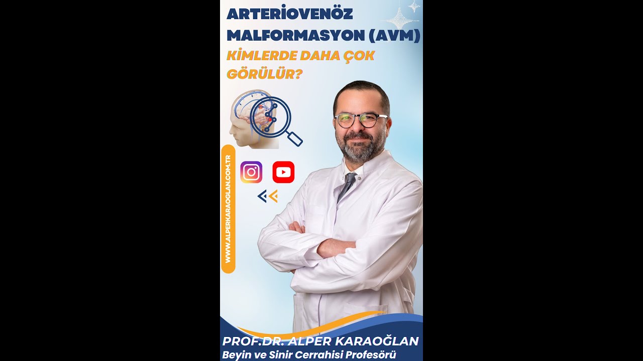 Arteriovenöz Malformasyon (AVM) (Damar Yumağı / Damar Yumaklanması) Kimlerde Daha Çok Görülür?