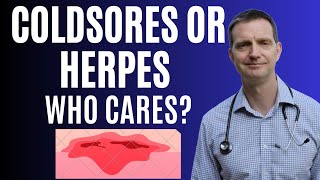 Coldsores and herpes, same infection different stigma. How We Treat Cold Sores In Kids And The Stigma