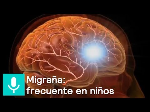 Vídeo: Migrañas En Los Niños: Cómo Puede Ayudarlos A Encontrar Alivio