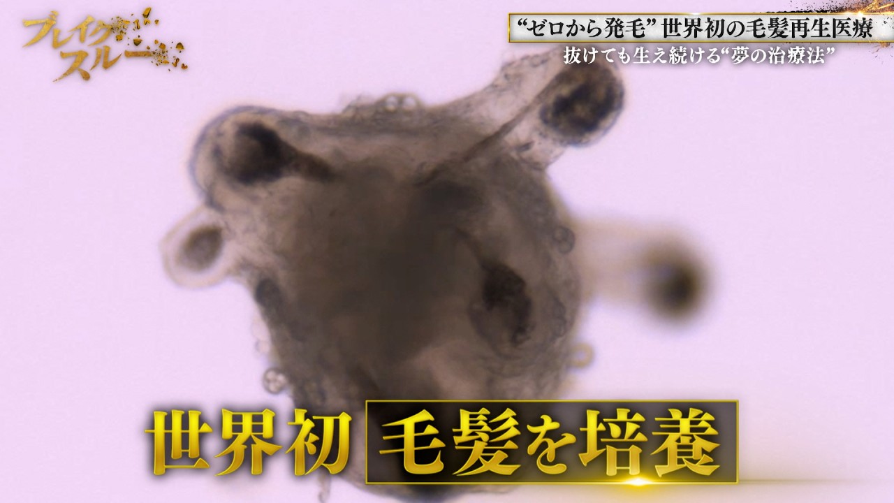 The world's first hair loss treatment! A 