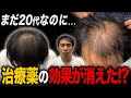 【20代薄毛】AGA治療をして10ヶ月経過した姿が衝撃すぎた...。