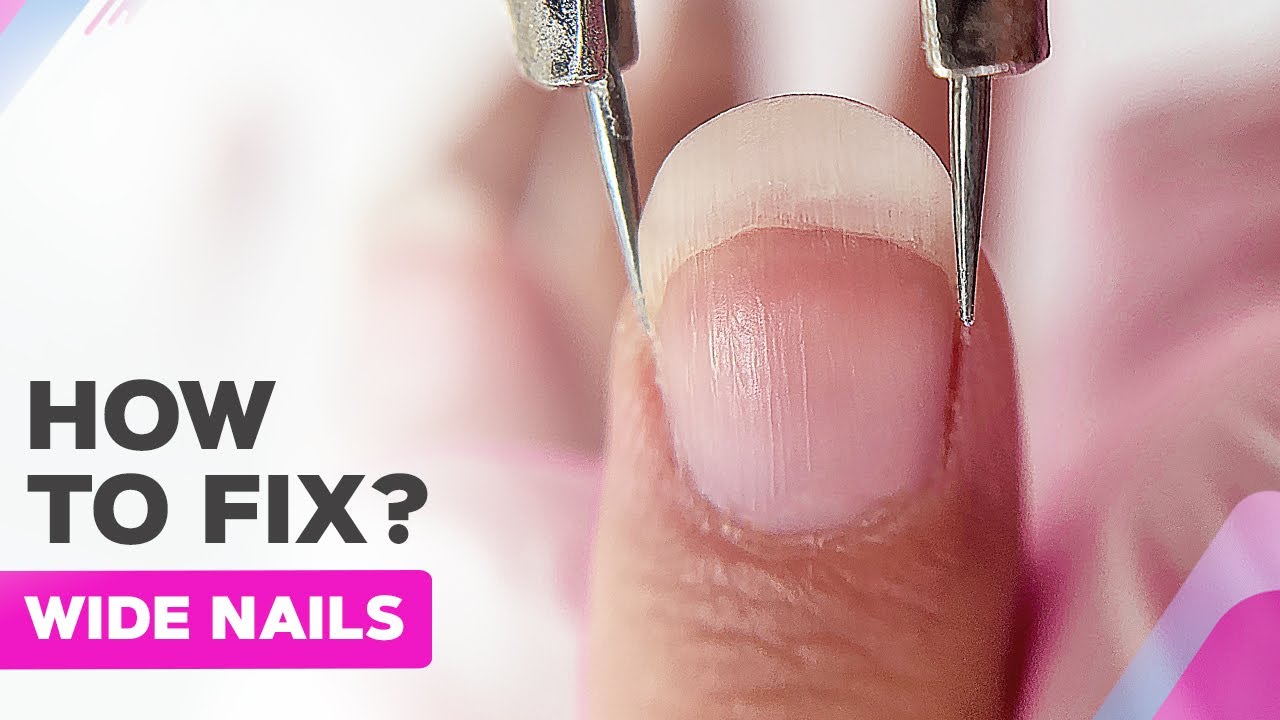 How To Address The Disappearing Nail Bed