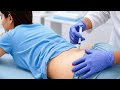 Don't Make This Mistake! IM Injection Technique Explained | Intramuscular Injection Guide