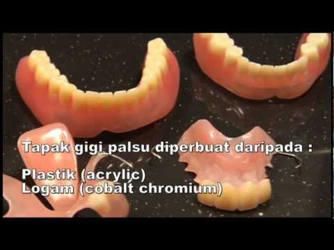 Video: Protokol Kebersihan Untuk Rawatan Stomatitis Berkaitan Dengan Gigi Palsu: Analisis Parameter Tempatan Dan Sistemik - Protokol Percubaan Double-blind