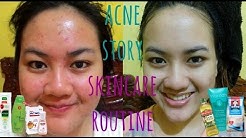 MY ACNE STORY + SKINCARE ROUTINE for ACNE SKIN | Cerita Lawan Jerawat + Skincare Jerawat (Indonesia) - Durasi: 16.48. 