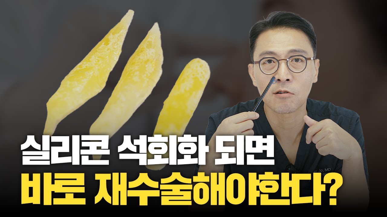 284화. 코성형수술 후 실리콘이 석회화 되면 위험한 건가?