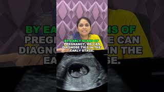 Ectopic pregnancy - symptoms and treatments| Dr. Rukkayal Fathima shorts