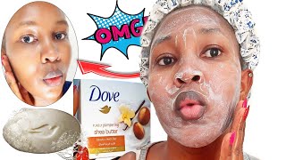 i used dove soap on my face for 1 week| see Results | Dove Soap Review