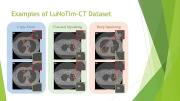Medical Image Tampering Detection: a New Dataset and Baseline