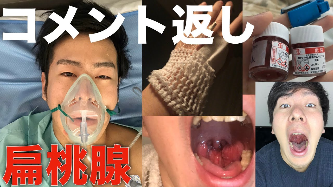 扁桃 腺 を 取る