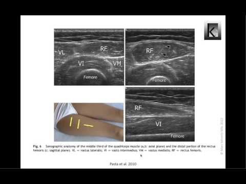 Video: Sonogramm Gegen Ultraschall