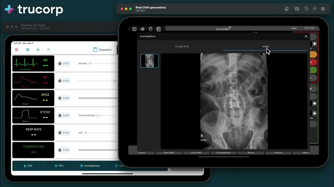 TruMonitor Quick Start Investigations YouTube