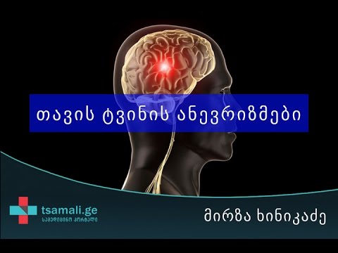 თავის ტვინის ანევრიზმები - მირზა ხინიკაძე