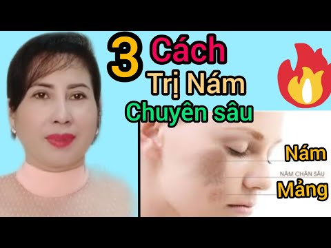 top 3 kem trị thâm Nám Mụn tại nhà hiệu quả và vô cùng bình Dân# #