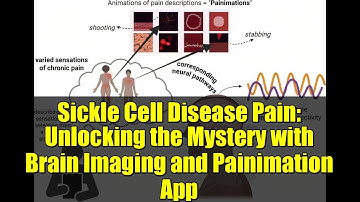 Sickle Cell Disease Pain: Unlocking the Mystery with Brain Imaging and Painimation App