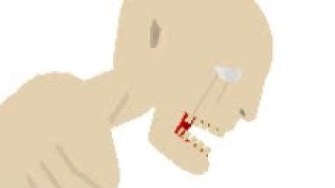 SCP-096 Story| Stick Nodes “How it started”