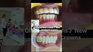smile makeover  brings changes in life