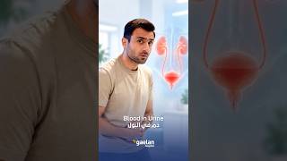 Urology in Sharjah | طب المسالك البولية في الشارقة