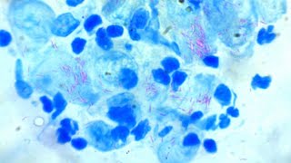 Feline leprosy / cutaneous Mycobacteriosis screenshot 4