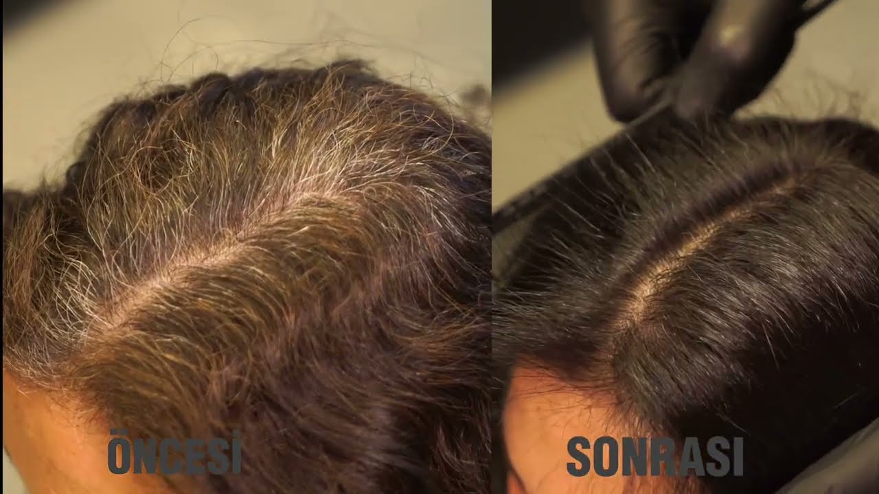 Hızlı Beyaz Kapatıcı Şampuanlar Kadınlar için Nasıl Kullanılır? | Morfose Cosmetics