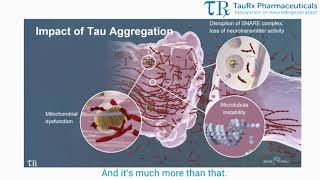 Tau and the Aging Brain Part 2 - The Brain and Tau Pathology Mini Series
