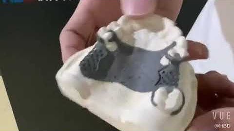 HBD Metal 3D Printing Removable Partial Dentures