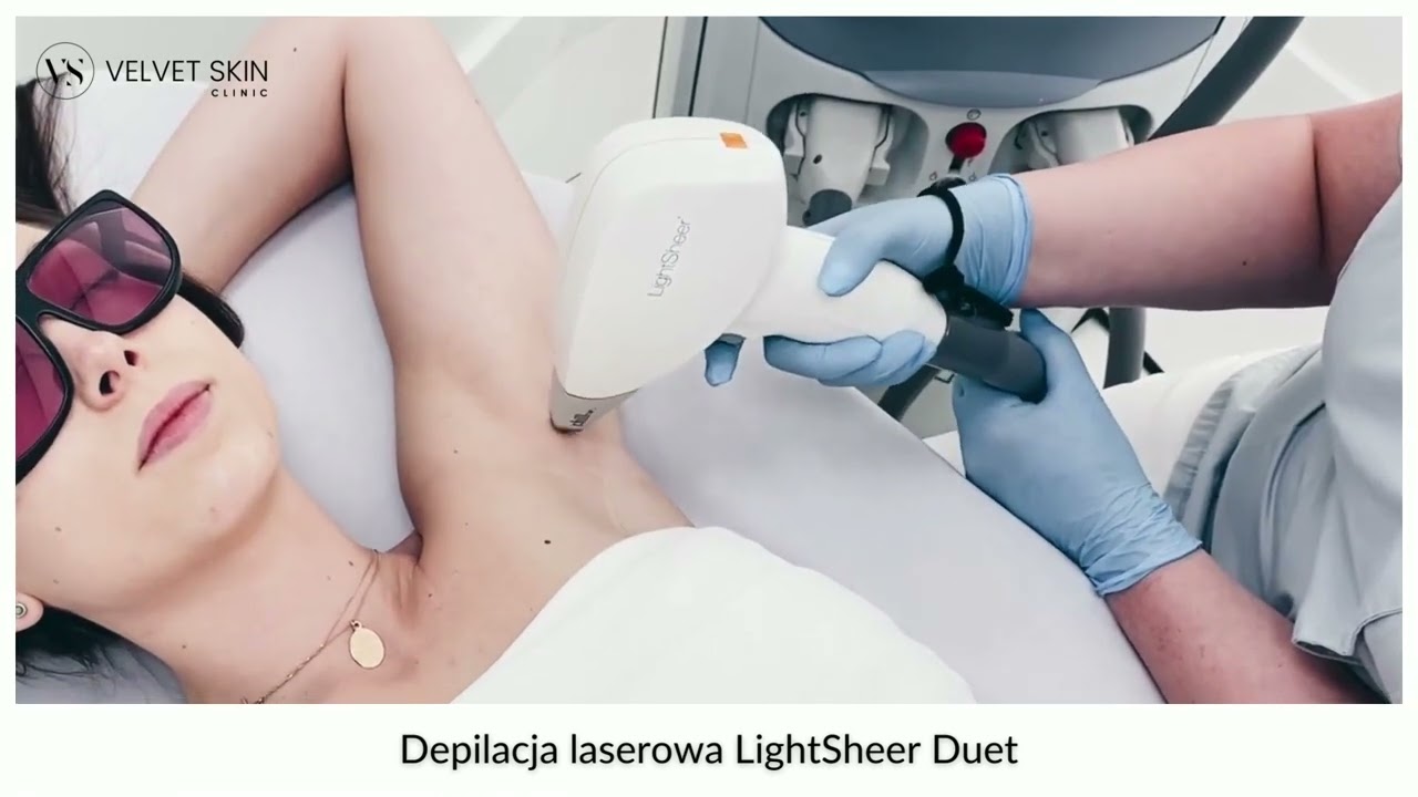 Depilacja laserowa LightSheer — praca głowicy na różnych partiach ciała