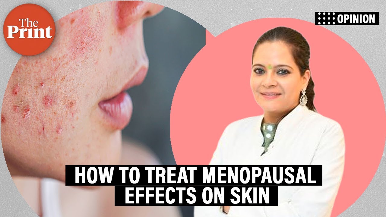 Eczema, acne, facial hair—menopausal effect on skin shouldn’t make you