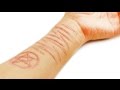 Get Rid Tattoo Removal Cream