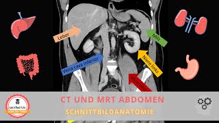 Schnittbildgebung des Abdomens: Anatomie