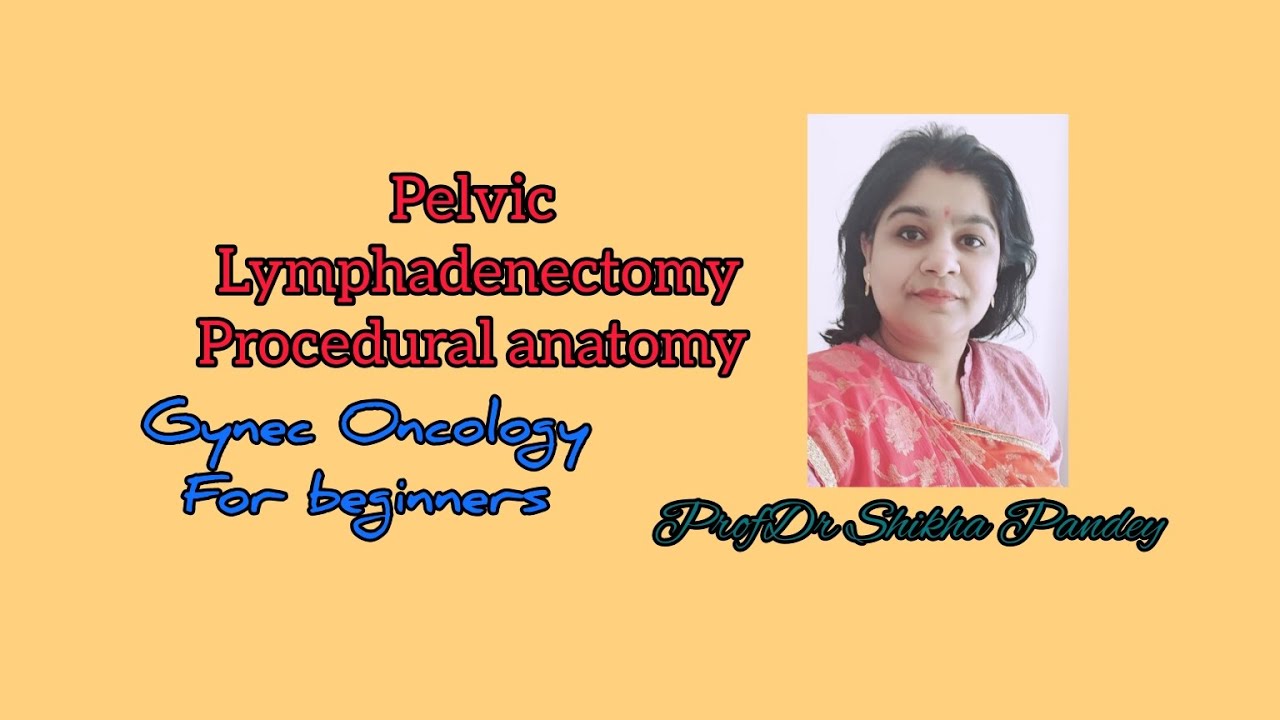 Pelvic Lymph Node Dissection Radical Hysterectomy Nerve Sparing pelvic-lymph-node-dissection-radical-hysterectomy-nerve-sparing