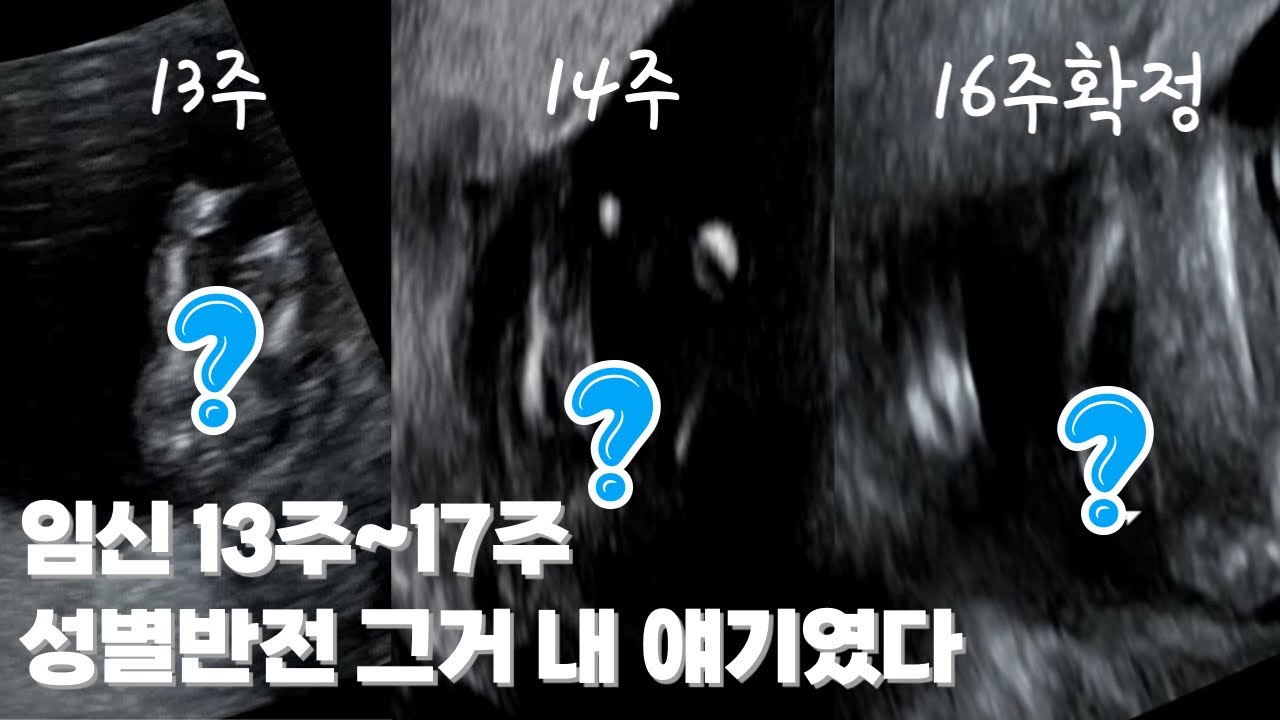 [임신13주~17주] 성별반전 그거 내 얘기였다 / 그래도 건강하게 있어줘서 고마워