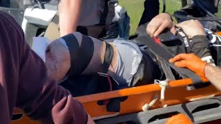I Broke My Tib, Fib And Knee
