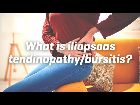 Video: Ce este sindromul iliopsoas?