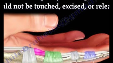 Trigger Finger and trigger thumb - Everything You Need To Know - Dr. Nabil Ebraheim